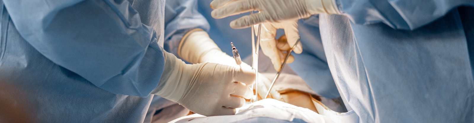 Entenda a relação entre hérnia de hiato e refluxo, quando os medicamentos podem não ser suficientes e em quais casos a cirurgia pode ser indicada.